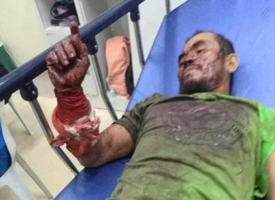 ​菲律宾男子咬死 3 米巨蟒：遭蟒蛇咬伤缠身后，他狠咬蛇脖子自救