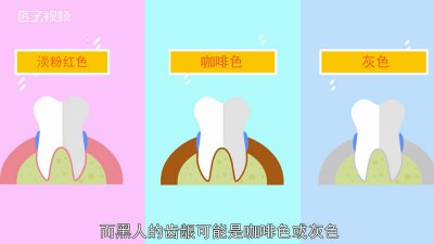 ​牙龈是哪里图解 齿龈示意图