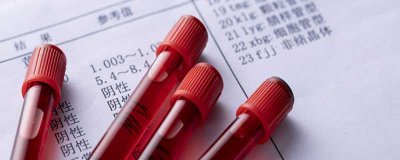 ​核酸检测要多久出结果新冠 做了新冠核酸检测多久出结果