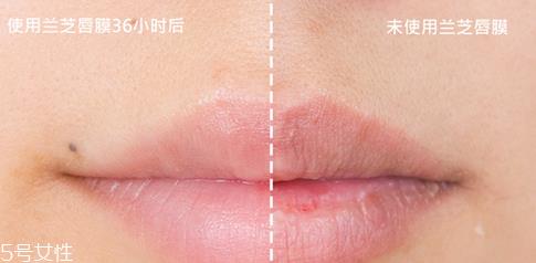 兰芝唇膜小孩能用吗？兰芝唇膜正确使用方法