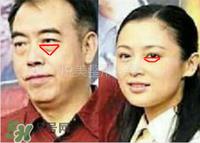 卧蚕是黑眼圈吗？卧蚕和黑眼圈的区别