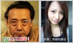 卧蚕是黑眼圈吗？卧蚕和黑眼圈的区别