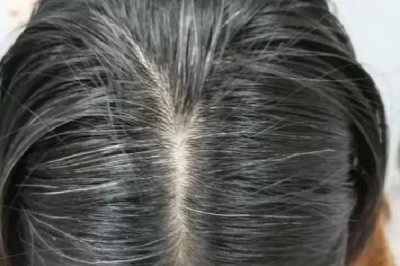 ​白头发和性生活频繁有关系吗 白头发是肾阴虚还是肾阳虚