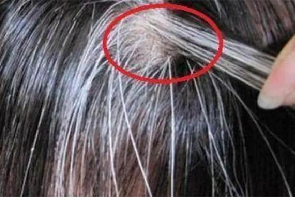白头发和性生活频繁有关系吗 白头发是肾阴虚还是肾阳虚