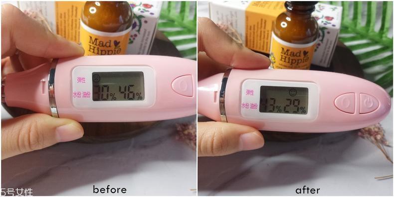 mad hippie维a精华适合肤质 mad hippie va精华功效