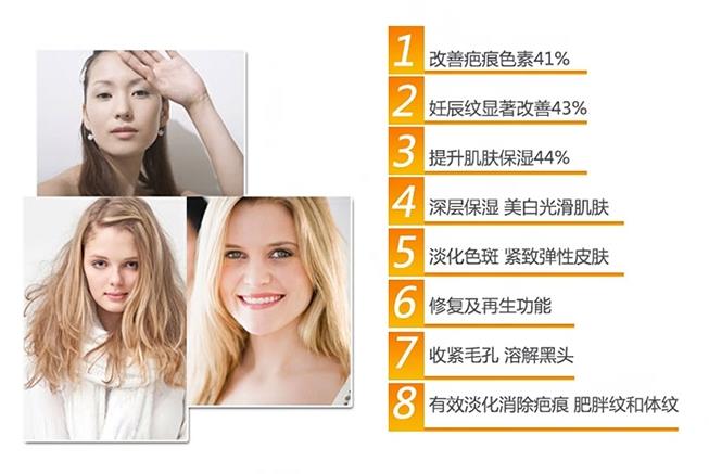 swisse玫瑰果油好用吗 有助改善疤痕和妊娠纹