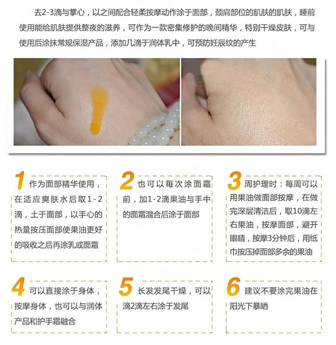 swisse玫瑰果油好用吗 有助改善疤痕和妊娠纹