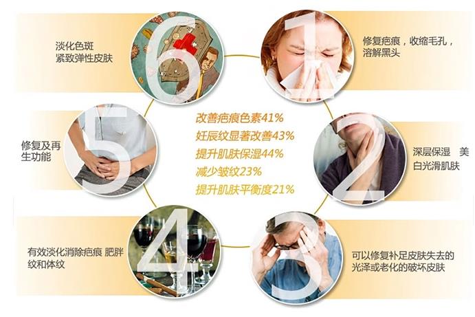 swisse玫瑰果油好用吗 有助改善疤痕和妊娠纹
