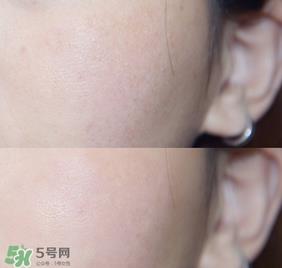 rosamin若美欣杏仁酸精华液怎么样_好用吗