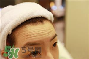 抬头纹怎么去除?抬头纹怎么避免?