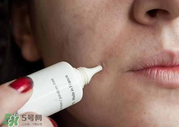 痤疮的分类 痤疮的护理原则