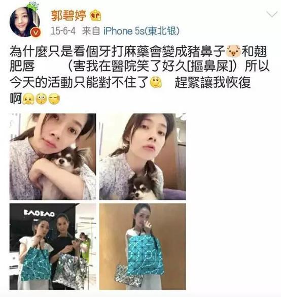 宅男女神郭碧婷整容导致脸残？毫无演技的她究竟为何受人青睐？
