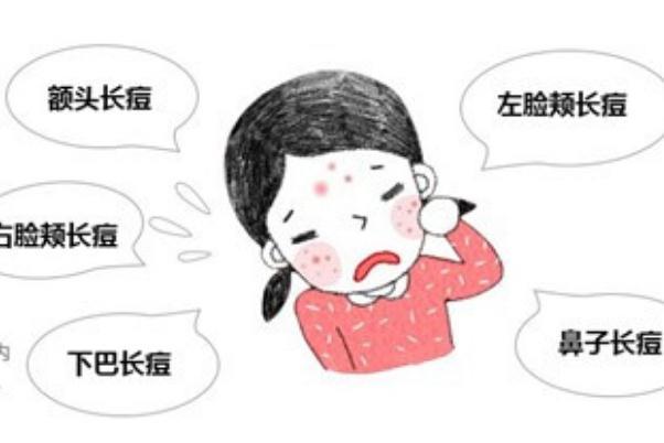 青春痘是皮肤病吗 青春痘要挤掉吗