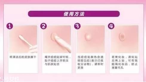 痘痘贴什么时候贴 刚挤完有伤口的时候
