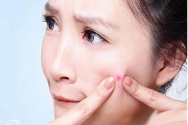女生脸上长痘怎么调理 女生脸上长痘吃什么水果好