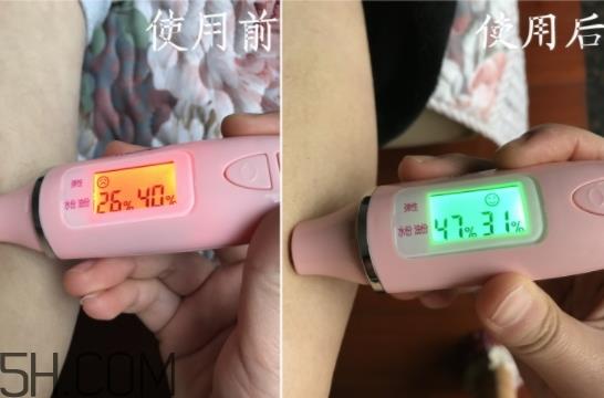 水杨酸可以去黑头吗？水杨酸可以去闭口吗