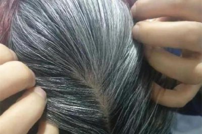 ​白头发多是体内缺少什么元素 白头发补维生素b几