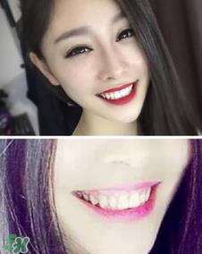 碧缇福冷光牙齿美白仪怎么用？碧缇福冷光牙齿美白仪使用方法