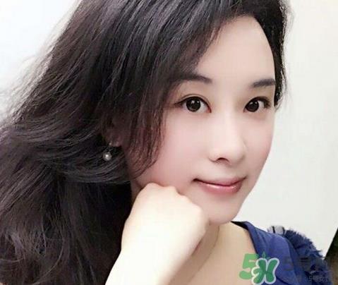 嘴唇脱皮是缺维生素几?嘴唇脱皮是缺什么维生素?