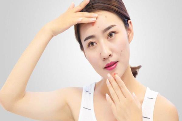痘痘长到多少岁 长痘需要注意些什么