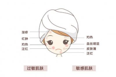 ​敏感肌怎样修复成正常肌肤 敏感肌肤适合什么牌子的护肤品