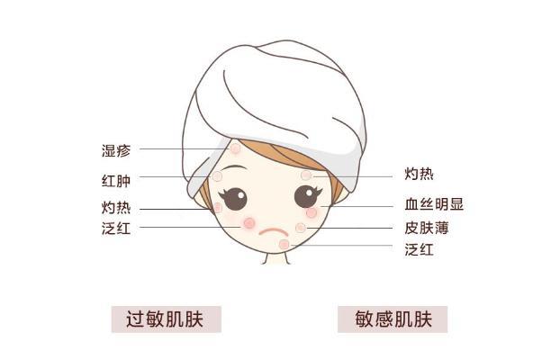 敏感肌怎样修复成正常肌肤 敏感肌肤适合什么牌子的护肤品