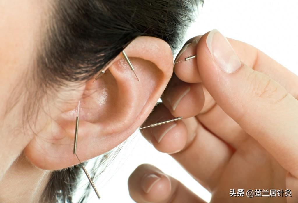 中国针灸图集