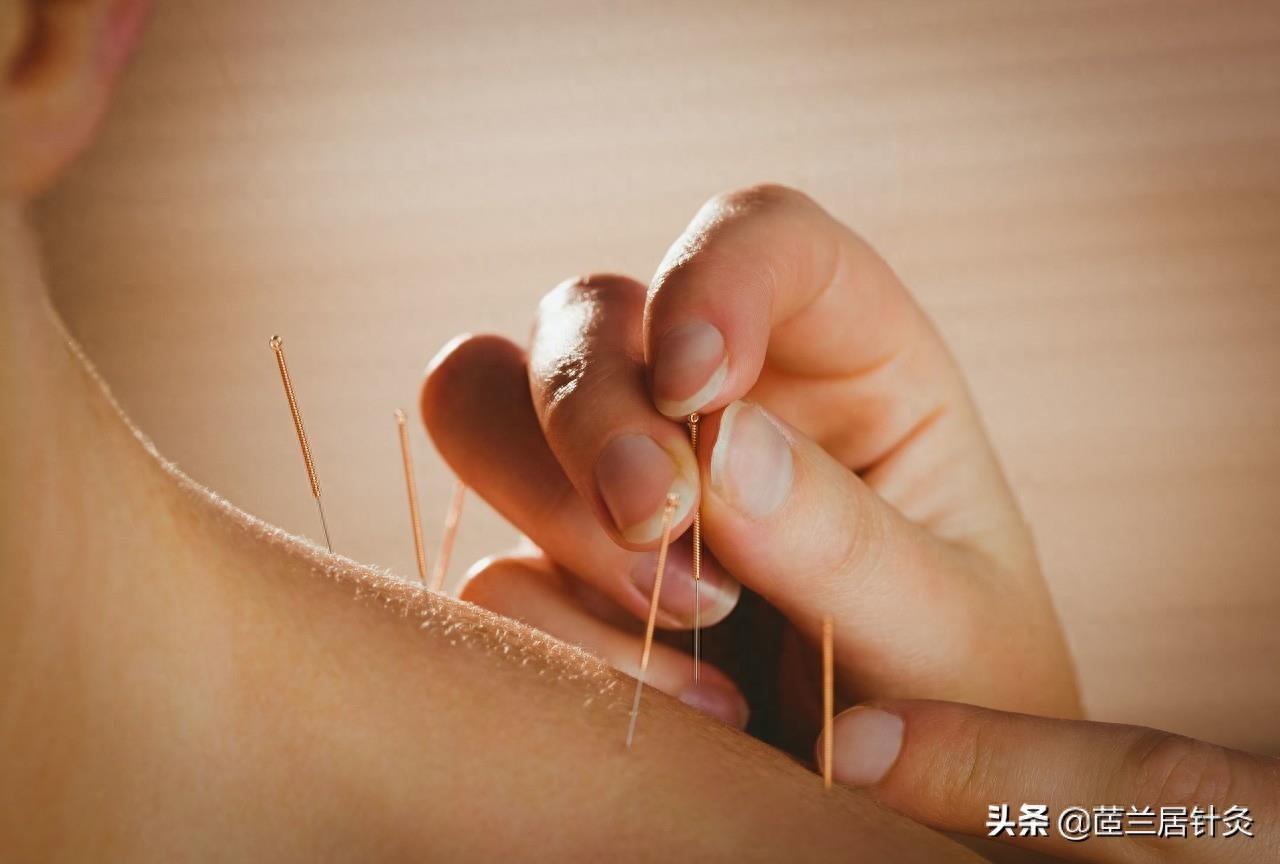 中国针灸图集